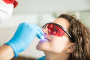Professional Teeth Whitening VS Over-The-Counter Whitening